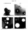 Fig. 19 - Lipid membrane structure, lipid-membrane-structure-immobilization carrier, and method of fusing vesicles