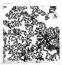 Fig. 03 - HOLLOW METAL NANOPARTICLE, CATALYST INCLUDING SAME, AND METHOD FOR MANUFACTURING HOLLOW METAL NANOPARTICLE