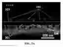 Fig. 05 - Isolation and detection of circulating tumor cells (CTCs)