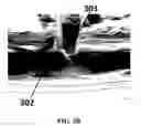 Fig. 06 - Isolation and detection of circulating tumor cells (CTCs)