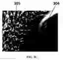 Fig. 07 - Isolation and detection of circulating tumor cells (CTCs)