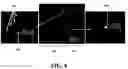 Fig. 12 - Isolation and detection of circulating tumor cells (CTCs)