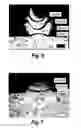 Fig. 04 - Additive manufacture of electrically conductive materials
