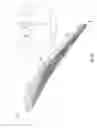 Fig. 04 - Edge preparation for laser welding