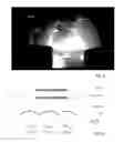 Fig. 11 - Methods for photo-curing with displaceable self-lubricating substratum for the formation of three-dimensional objects