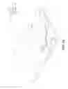 Fig. 22 - Selective attachment of a yarn structure