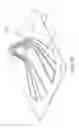 Fig. 25 - Selective attachment of a yarn structure