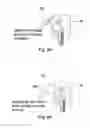 Fig. 09 - MATERIAL PROCESSING METHODS AND RELATED APPARATUS