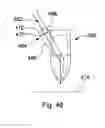 Fig. 34 - MATERIAL PROCESSING METHODS AND RELATED APPARATUS