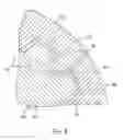 Fig. 05 - Power transfer structure of vehicle