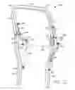 Fig. 11 - Deployable operator protection apparatus with an over-center linkage