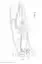 Fig. 05 - Bumper assembly including lower leg stiffener