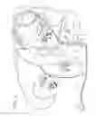 Fig. 02 - BRAKE LINE BLEEDING DEVICE