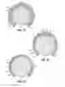 Fig. 15 - Steering Wheel Cover Having Clips