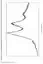 Fig. 02 - AMORPHOUS FORM OF BARICITINIB