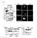 Fig. 05 - Compound for inhibiting binding between DX2 protein and P14/ARF protein, and pharmaceutical composition for treating or preventing cancer disease containing same as effective ingredient