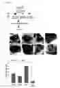 Fig. 11 - Compound for inhibiting binding between DX2 protein and P14/ARF protein, and pharmaceutical composition for treating or preventing cancer disease containing same as effective ingredient
