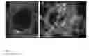 Fig. 03 - GrB-EHinhibitory peptides