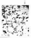 Fig. 04 - Process of preparing guanylate cyclase C agonisys