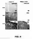 Fig. 06 - COMPOSITIONS AND METHODS FOR MODULATING NEURONAL DEGENERATION