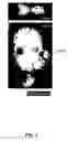 Fig. 04 - Method of treating bone disease