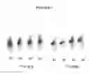 Fig. 08 - Uses of monoclonal antibody 8H9