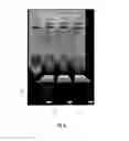 Fig. 11 - Anisotropic and amphiphilic particles and methods for producing and using the same