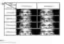 Fig. 07 - Microfluidic pressure regulator for robust hydrogel loading without bursting