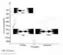 Fig. 16 - Microfluidic pressure regulator for robust hydrogel loading without bursting