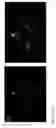Fig. 19 - Microfluidic pressure regulator for robust hydrogel loading without bursting