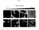 Fig. 06 - Methods for neural conversion of human embryonic stem cells