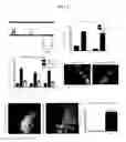 Fig. 23 - Methods for neural conversion of human embryonic stem cells