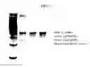 Fig. 14 - Intracellular genomic transplant and methods of therapy