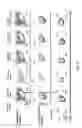 Fig. 33 - Intracellular genomic transplant and methods of therapy