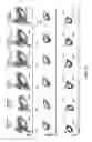 Fig. 34 - Intracellular genomic transplant and methods of therapy