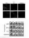 Fig. 04 - Composition for inducing direct transdifferentiation of somatic cell into vascular progenitor cell, and use thereof