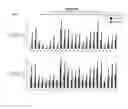 Fig. 07 - Methods and compositions for the specific inhibition of alpha-1 antitrypsin by double-stranded RNA