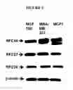 Fig. 05 - Replication factor C-40 (RFC40/RFC2) as a prognostic marker and target in estrogen positive and negative and triple negative breast cancer