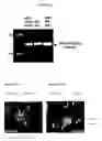 Fig. 09 - Replication factor C-40 (RFC40/RFC2) as a prognostic marker and target in estrogen positive and negative and triple negative breast cancer