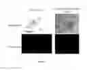 Fig. 04 - METHODS OF PLANT TRANSFORMATION USING TRANSFORMABLE CELL SUSPENSION CULTURE AND USES THEREOF