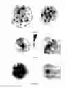 Fig. 10 - METHODS OF PLANT TRANSFORMATION USING TRANSFORMABLE CELL SUSPENSION CULTURE AND USES THEREOF