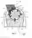 Fig. 04 - Processing biomass