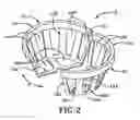 Fig. 03 - Removable hinged strainer for a pop-up drain assembly