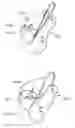 Fig. 37 - Sanitaryware cleaning system