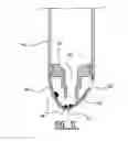 Fig. 09 - SHOE FOR A TUBULAR ELEMENT IN A WELLBORE