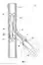 Fig. 02 - Wellbore operations using a multi-tube system