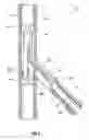 Fig. 03 - Wellbore operations using a multi-tube system