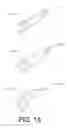 Fig. 14 - Overtensioning fastening tool