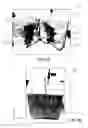 Fig. 07 - Methods and apparatus for spatially-oriented chemically-induced pulsed fracturing in reservoirs