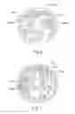 Fig. 06 - Remanufacturing a transmission pump assembly